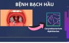 BÀI TUYÊN TRUYỀN  PHÒNG CHỐNG BỆNH BẠCH HẦU   