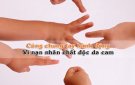 THẢM HỌA DA CAM Ở VIỆT NAM- NỖI ĐAU KHÔNG CỦA RIÊNG AI (10/8/1961-10/8/2024)